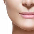 How Long Does It Take for Restylane to Settle?