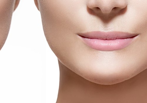 The Lasting Effects of Dermal Fillers