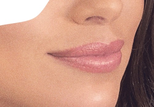 Can Restylane Be Used for Lip Enhancement?